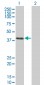 CLN3 Antibody (monoclonal) (M03)